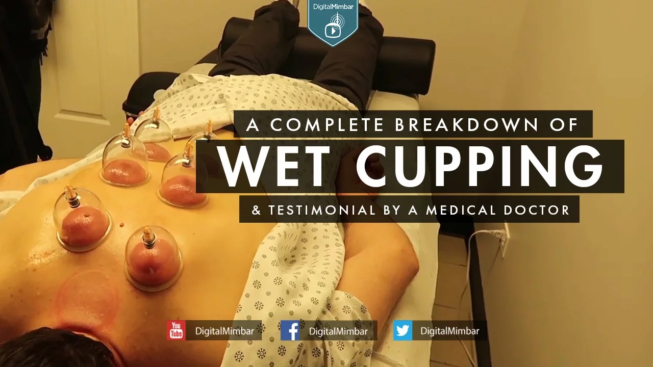 A Complete Breakdown of Wet Cupping.webp