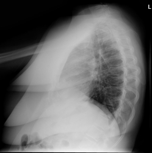 CXR195_IM-0618-1001.png